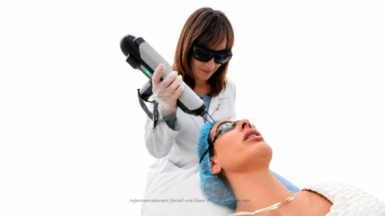 tratamiento para melasma con láser de picosegundo